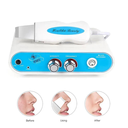 Ultrasonic Facial Skin Scrubber